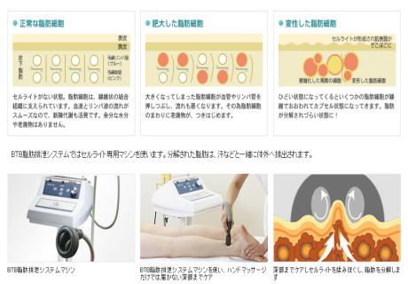 セルライトとはお尻や太ももに出来る肌のでこぼこのことで、女性の90%が持つといわれています。セルライトは運動や食事制限では落ちないため、取り除くには特別な処置が必要です。